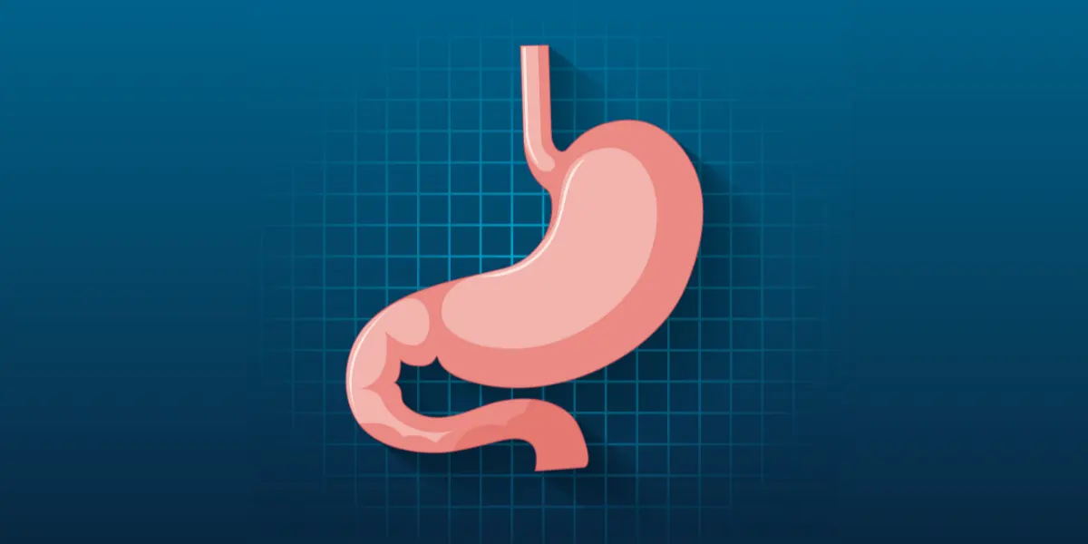 6. Tipos de cirurgia bariatrica quais os principais e o mais adequado para cada caso copiar