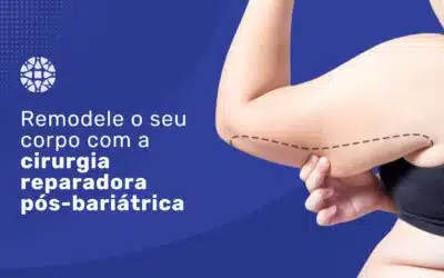 Transformação completa: cirurgia reparadora pós-bariátrica