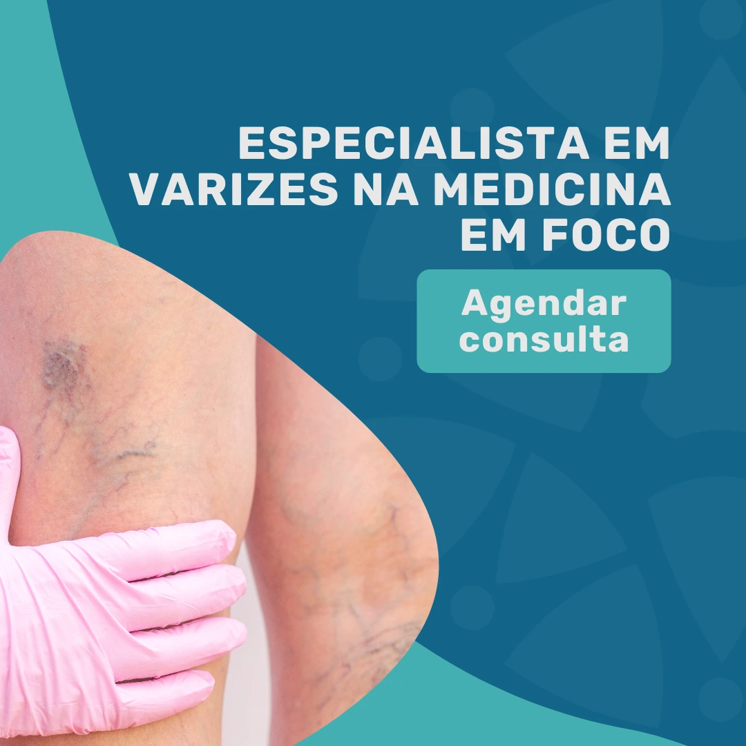 Encontre o seu especialista em varizes para o tratamento de varizes com Escleroterapia com Espuma pelo Bradesco Saúde 