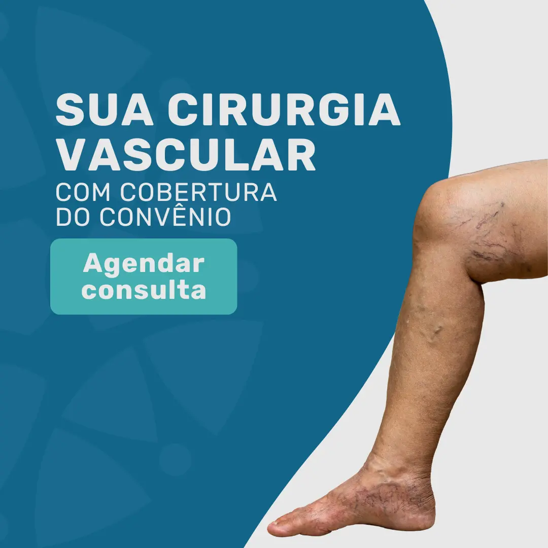 Faça a sua Cirurgia Vascular pelo convênio Mediservice Bradesco