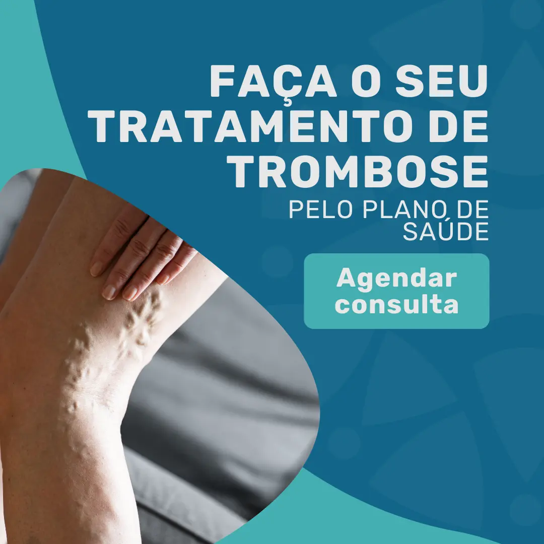 O seu Tratamento de trombose pelo plano de saúde Bradesco